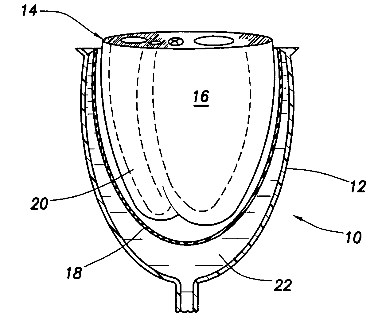 Device for proactive modulation of cardiac strain patterns