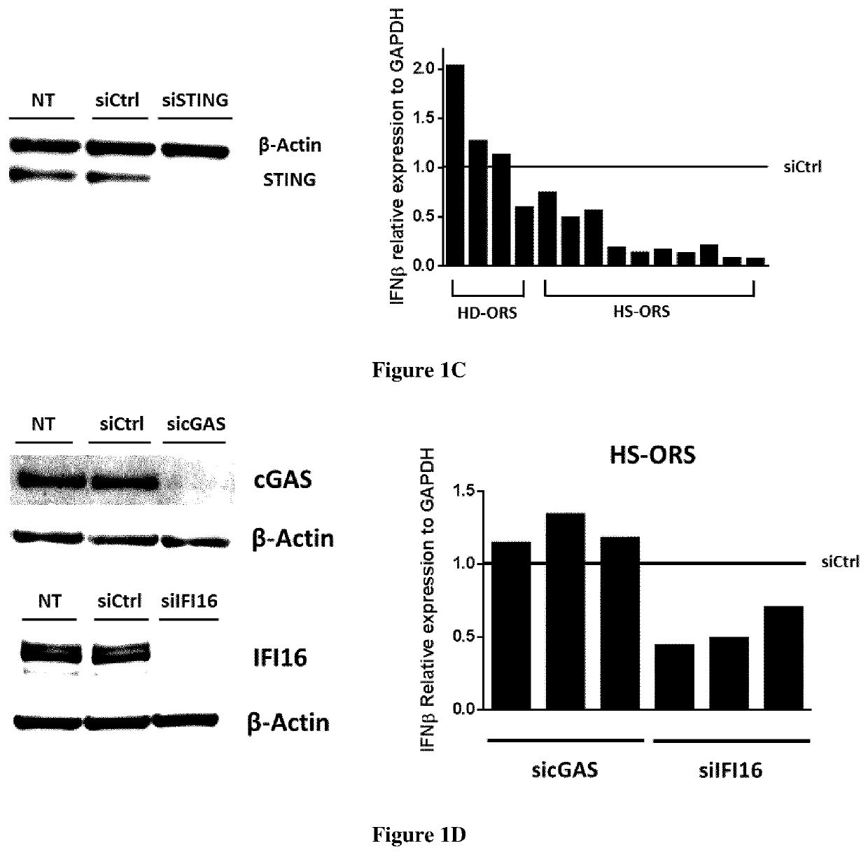 Inhibitors of the sting pathway for the treatment of hidradenitis suppurativa