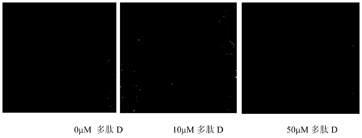 Fusion polypeptide, application of fusion polypeptide in enhancement of stem cell homing ability and anti-apoptotic ability and pharmaceutical composition