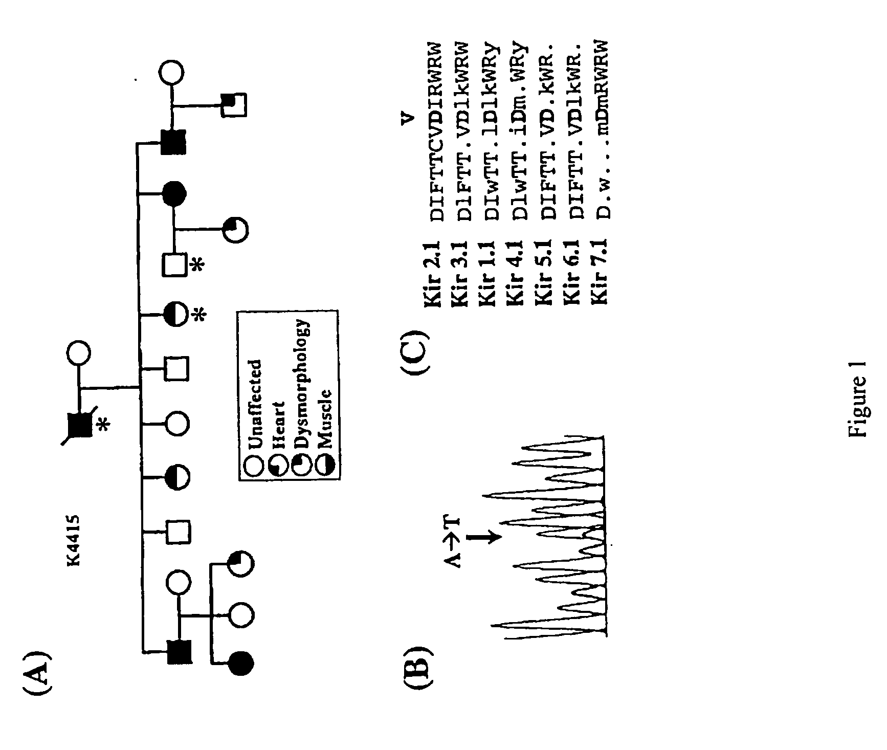 Methods for assessing risk for cardiac dysrythmia in a human subject