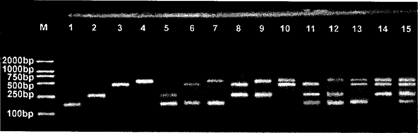 Multiple PCR detection reagent kit for pathogenic bacterium and its detecting method