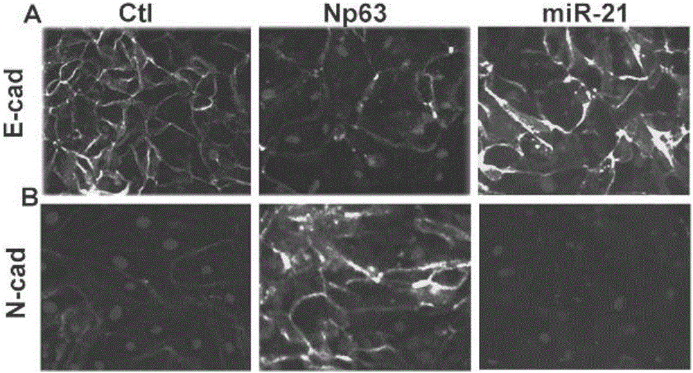 Application of miR-21 in preparation of medicine for treating intrauterine adhesion and/or thin inner membranes