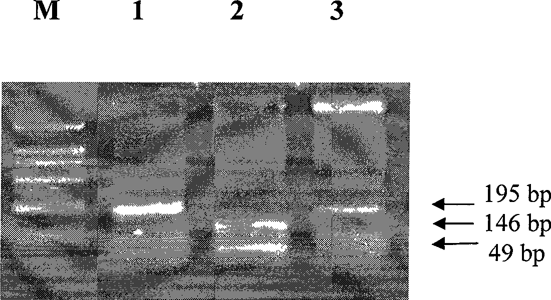 Construction method of Beta-alexin-2-tumor vaccine and uses thereof