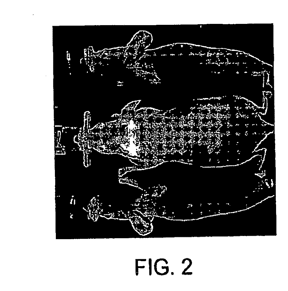 In-vivo optical imaging method including analysis of dynamic images