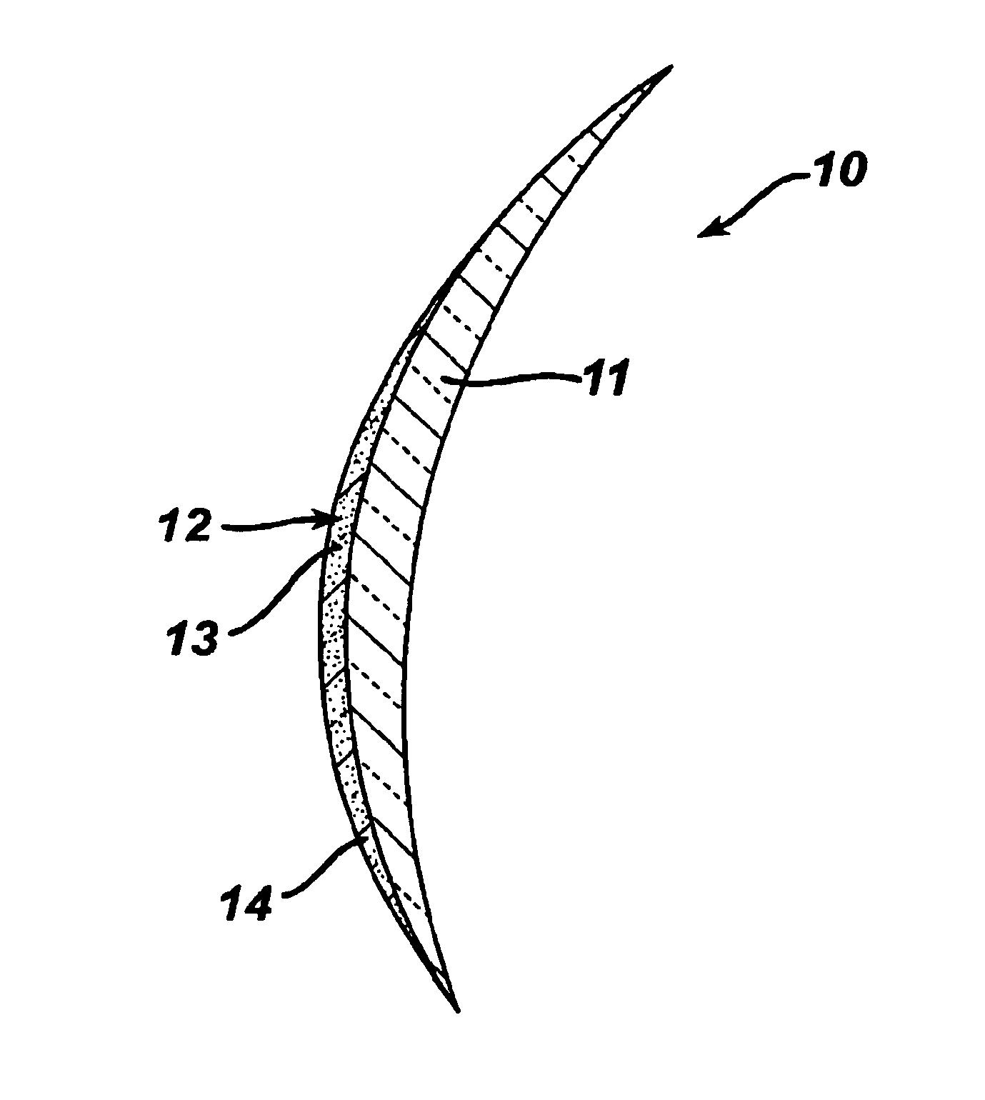 Method for manufacturing multifocal lenses