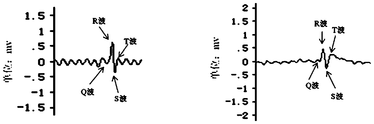 Composition for treating coronary heart disease