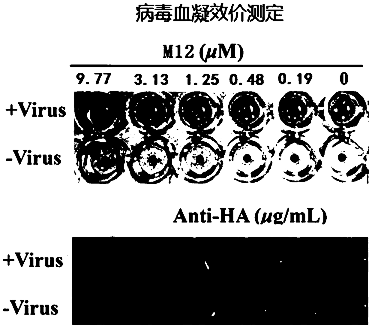 Triterpene-amino acid derivative as well as preparation method and application thereof