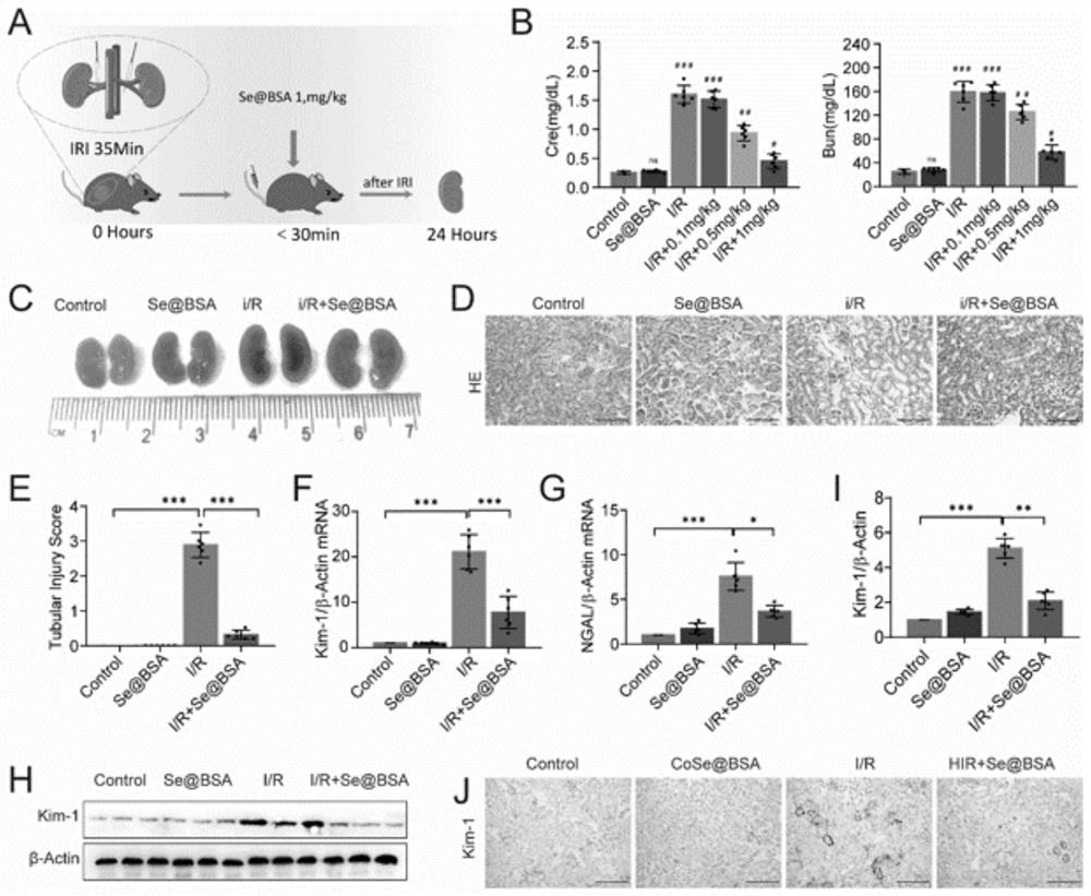 Preparation method of Se-coated BSA nano-drug and application of Se-coated BSA nano-drug in acute kidney injury