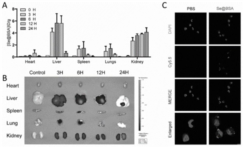 Preparation method of Se-coated BSA nano-drug and application of Se-coated BSA nano-drug in acute kidney injury