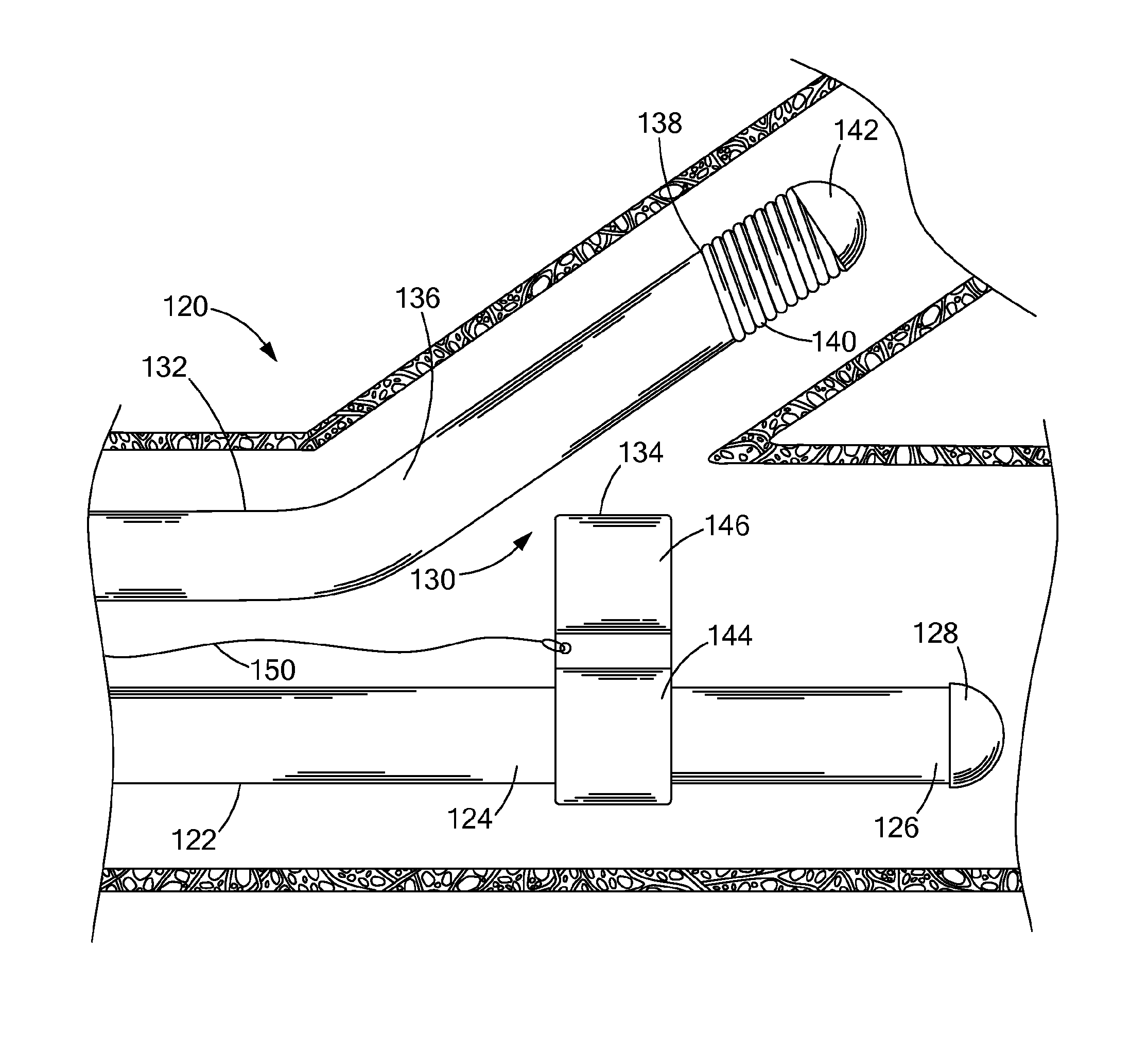 Medical systems, devices and methods for coupling wire guides