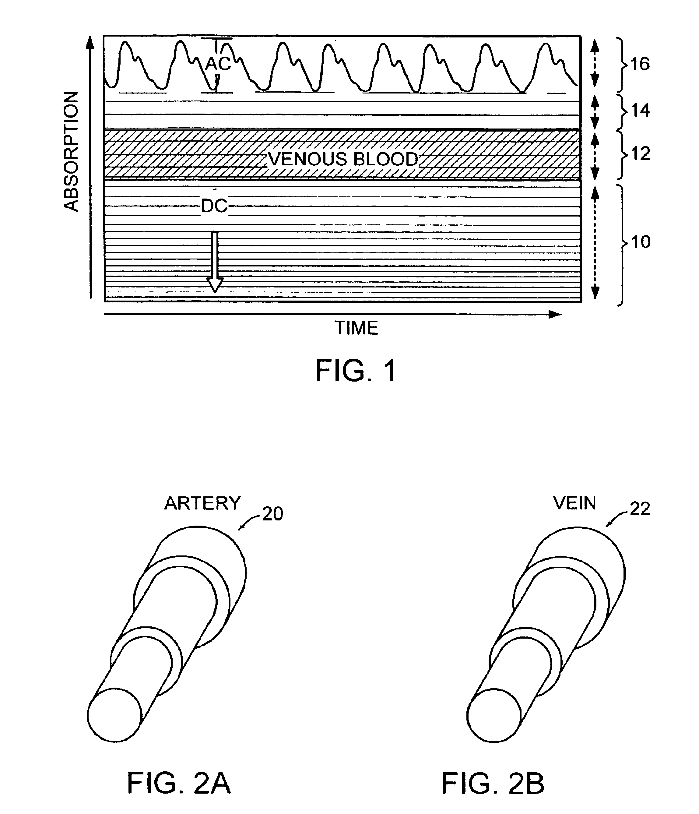 Vibratory venous and arterial oximetry sensor