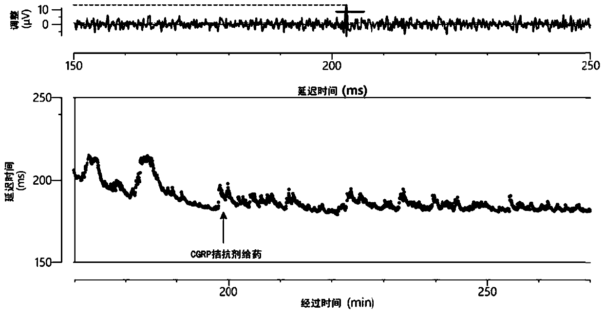 Use of cgrp receptor antagonists in neuroprotection and neurological disorders