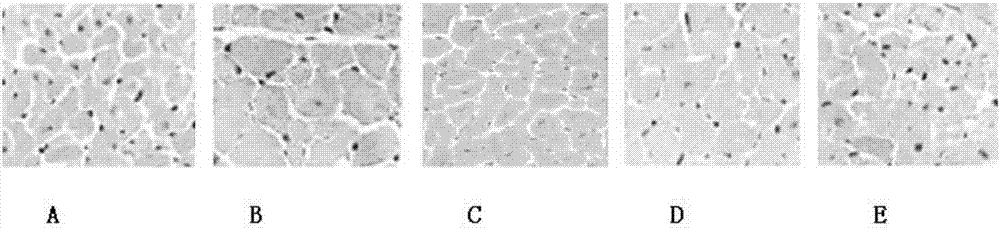 Application of gynostemma pentaphylla general flavone in preparation of medicines for preventing and treating cardiac hypertrophy