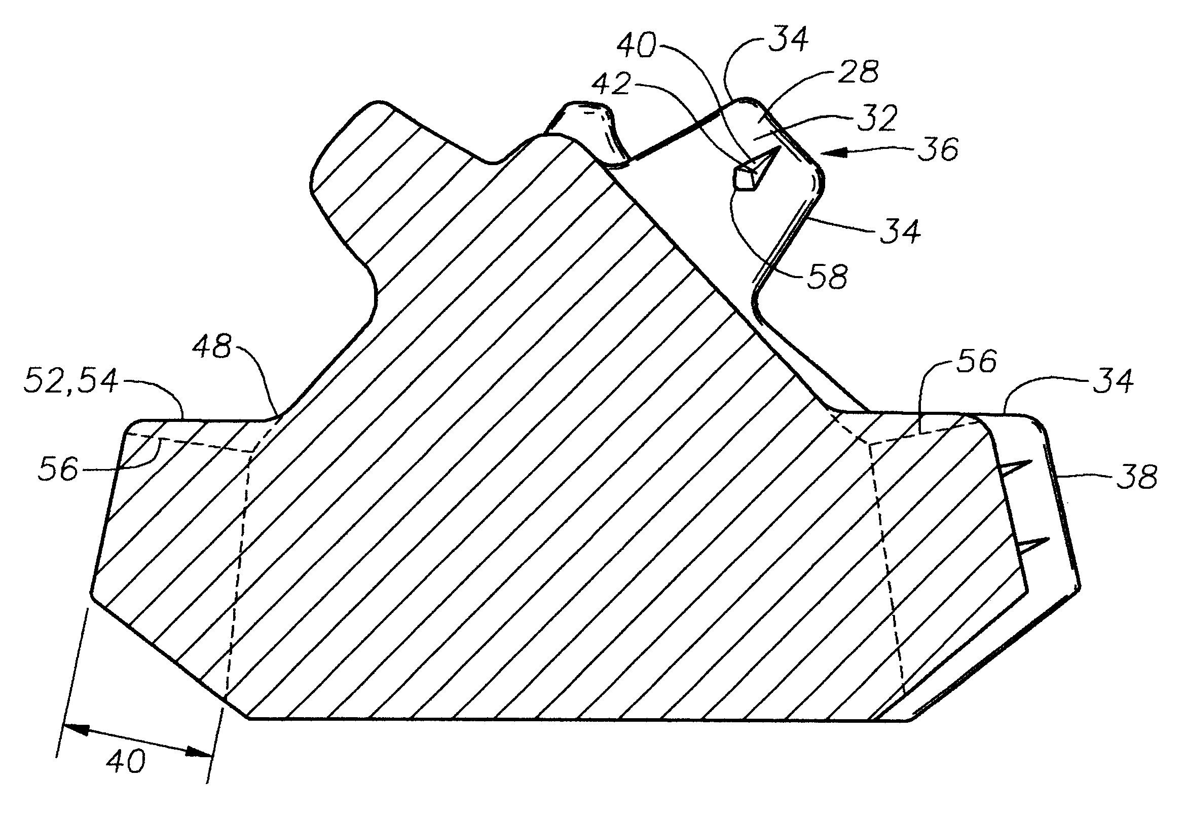 Tooth type drill bit with secondary cutting elements and stress reducing tooth geometry