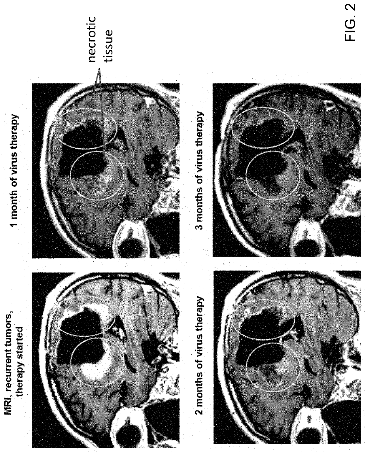 Delivery of oncolytic viruses using dendritic cells