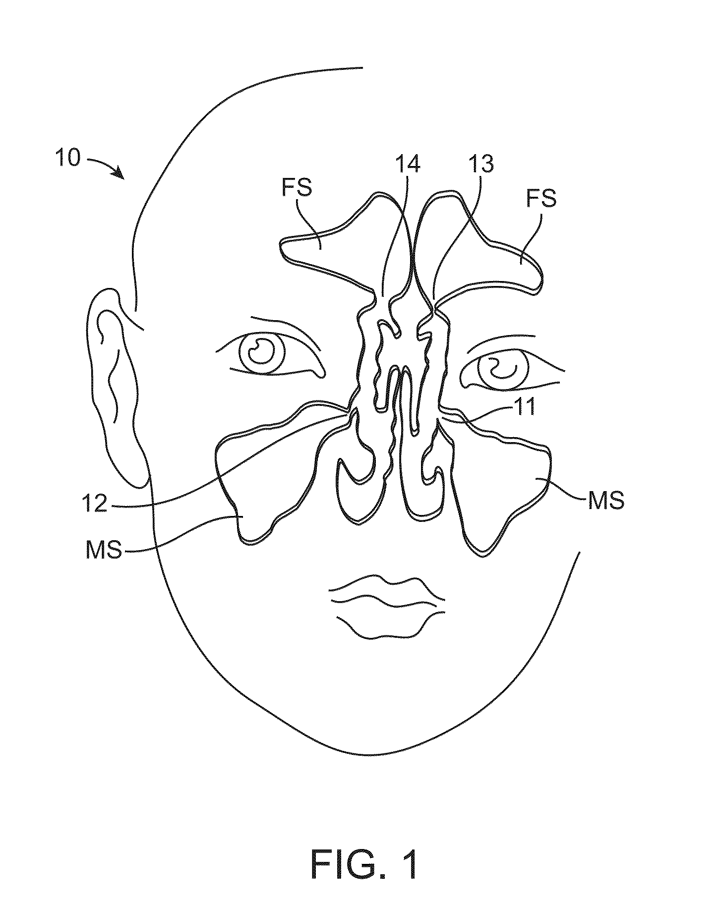 Devices and methods for inserting a sinus dilator