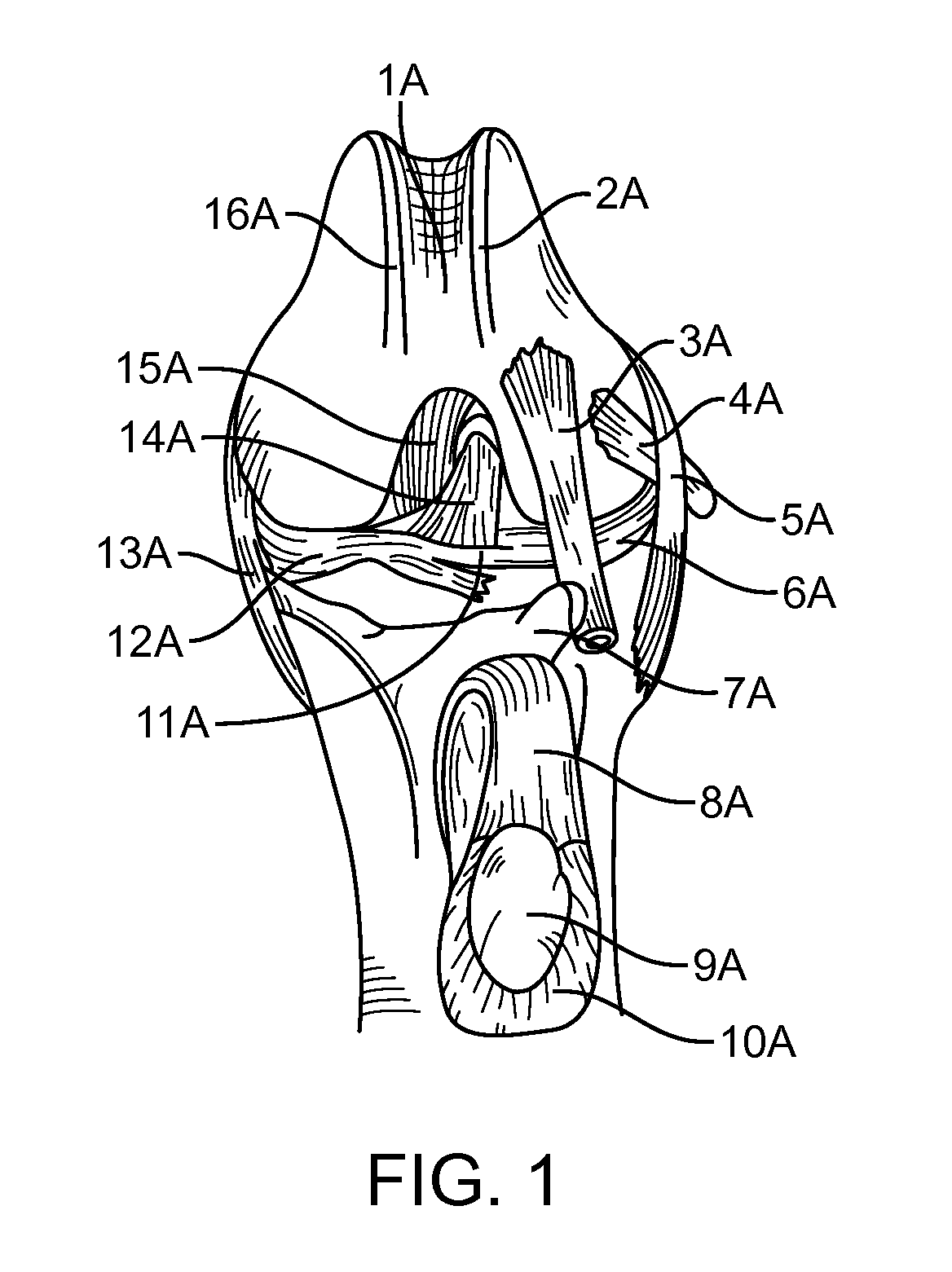 Method and Apparatus For Treating Canine Cruciate Ligament Disease