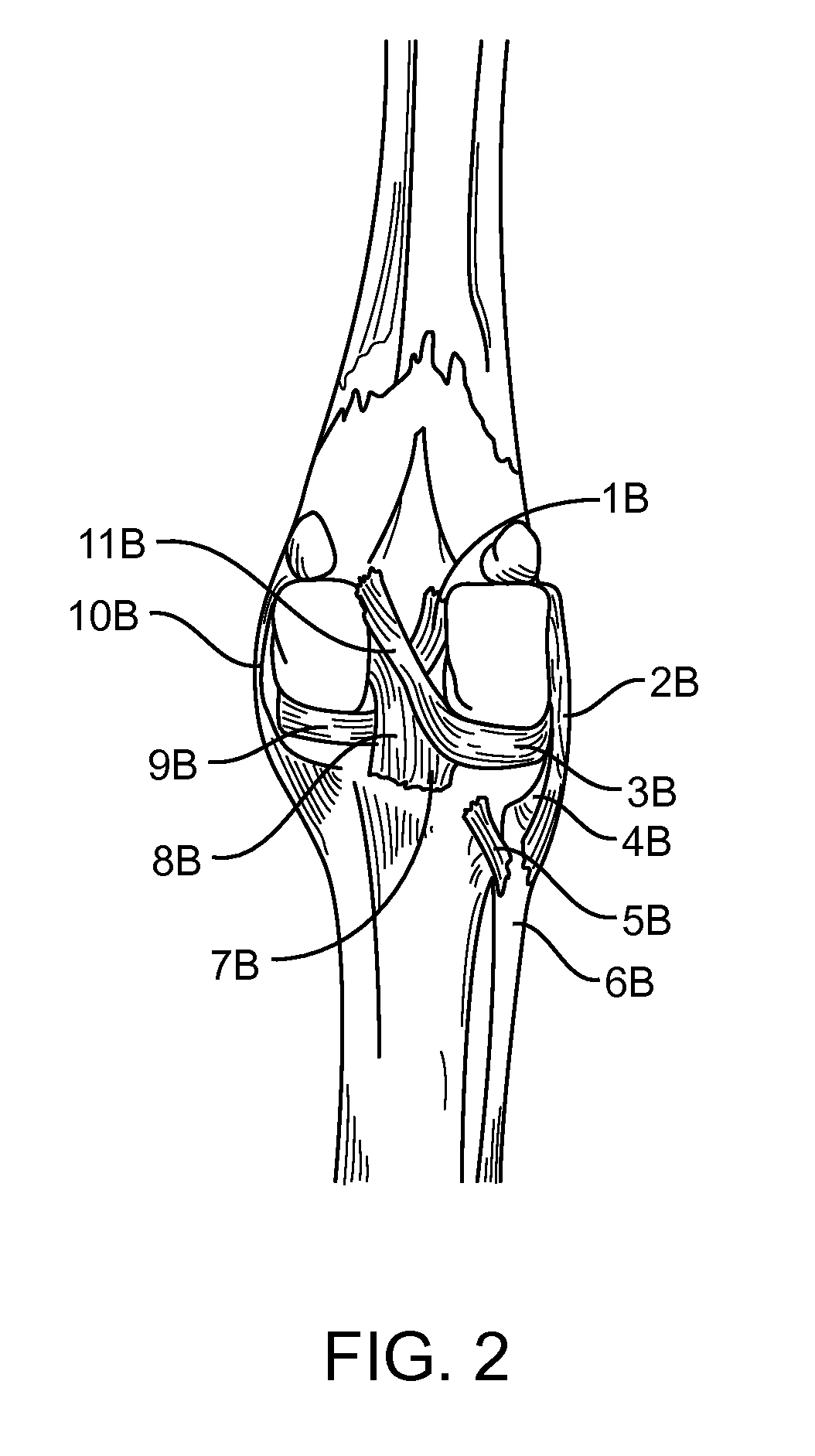 Method and Apparatus For Treating Canine Cruciate Ligament Disease