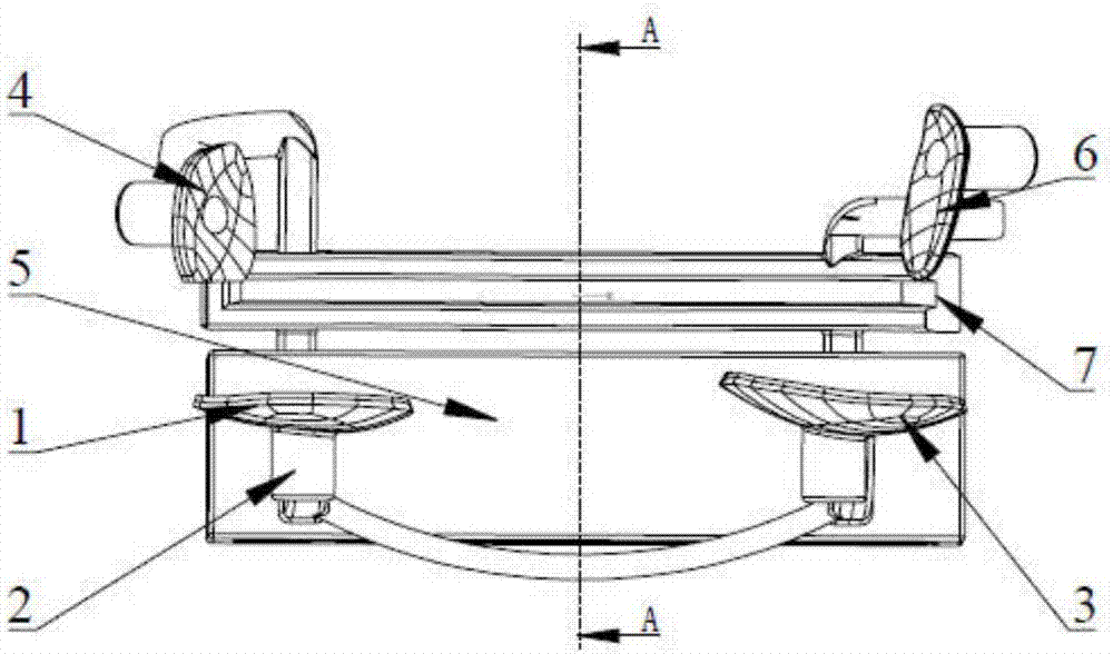 Distal femur customized osteotomy guide plate used for knee replacement surgery and implementation method