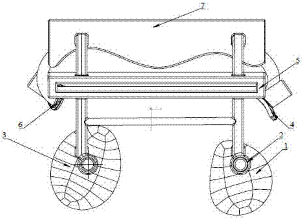 Distal femur customized osteotomy guide plate used for knee replacement surgery and implementation method