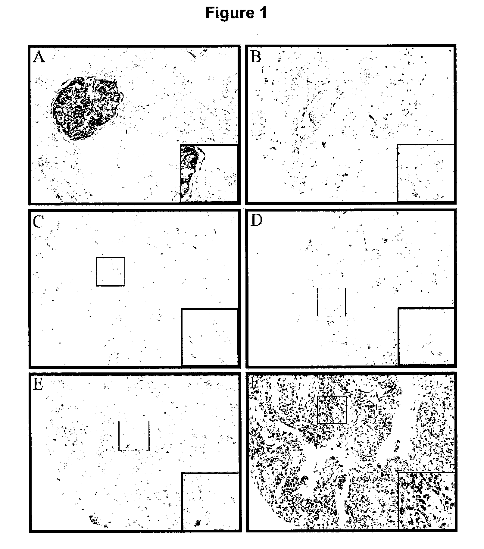 Methods for detecting and treating cancer