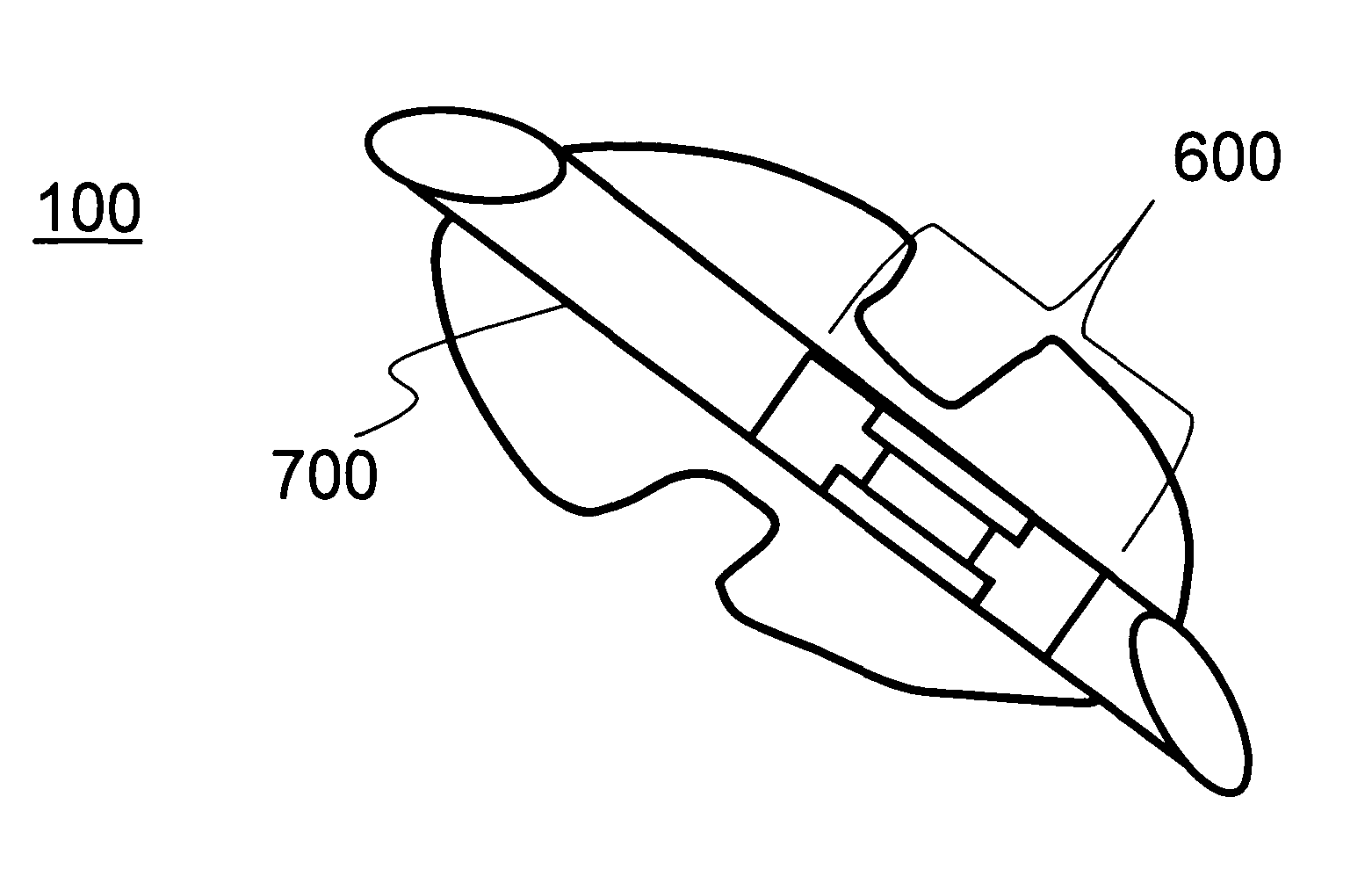 Implantable glaucoma drainage device