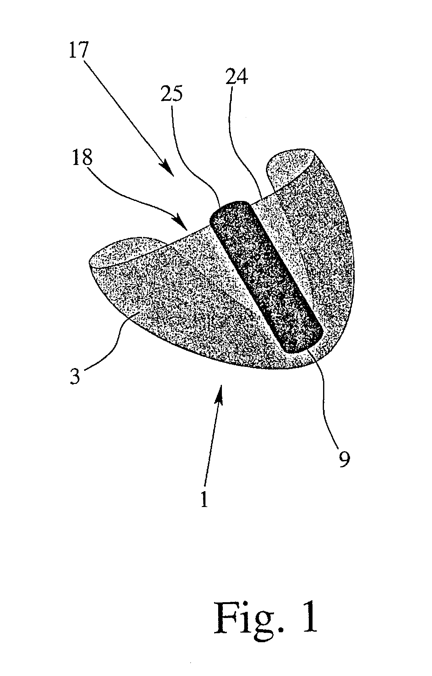 Device and system for assisting and/or taking over the pumping function of the heart