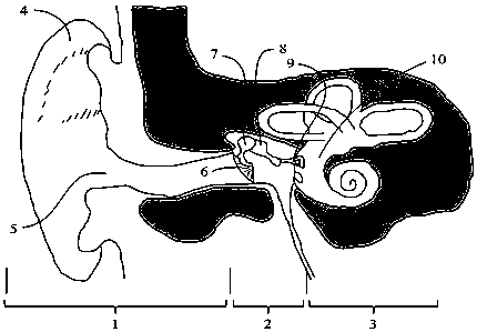 A Round Window Vibration Actuator with Adjustable Position and Posture