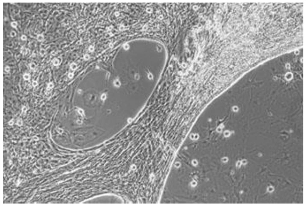 Method for separating and culturing mouse small intestine organoid capable of peristalsis in vitro