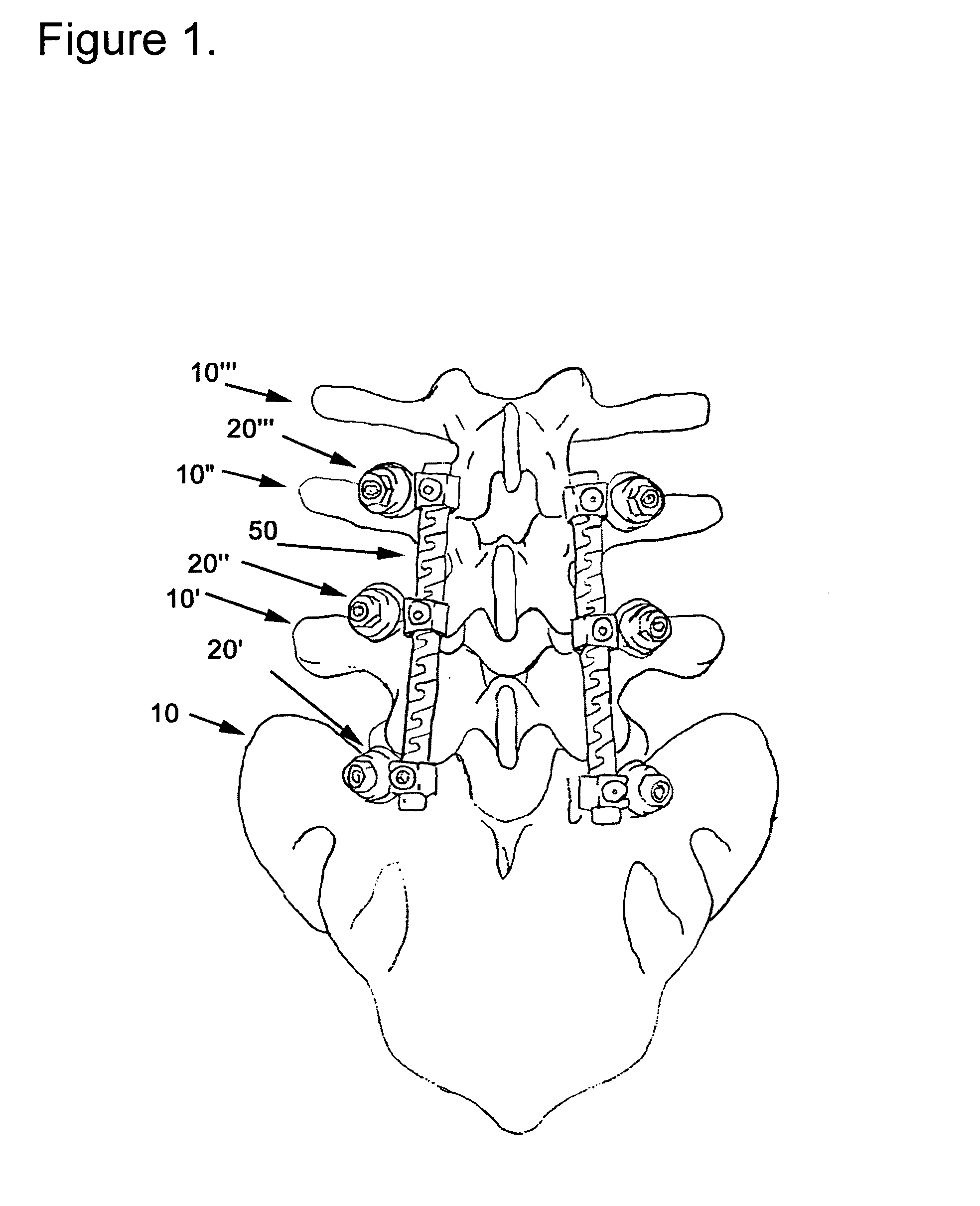 Flexible spine components