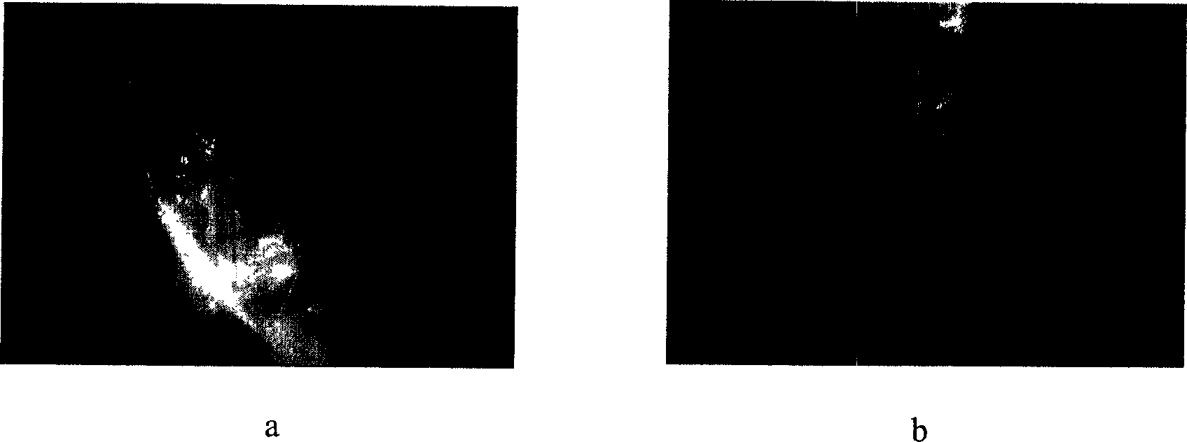 Microencapsulated saccharomyces and its application