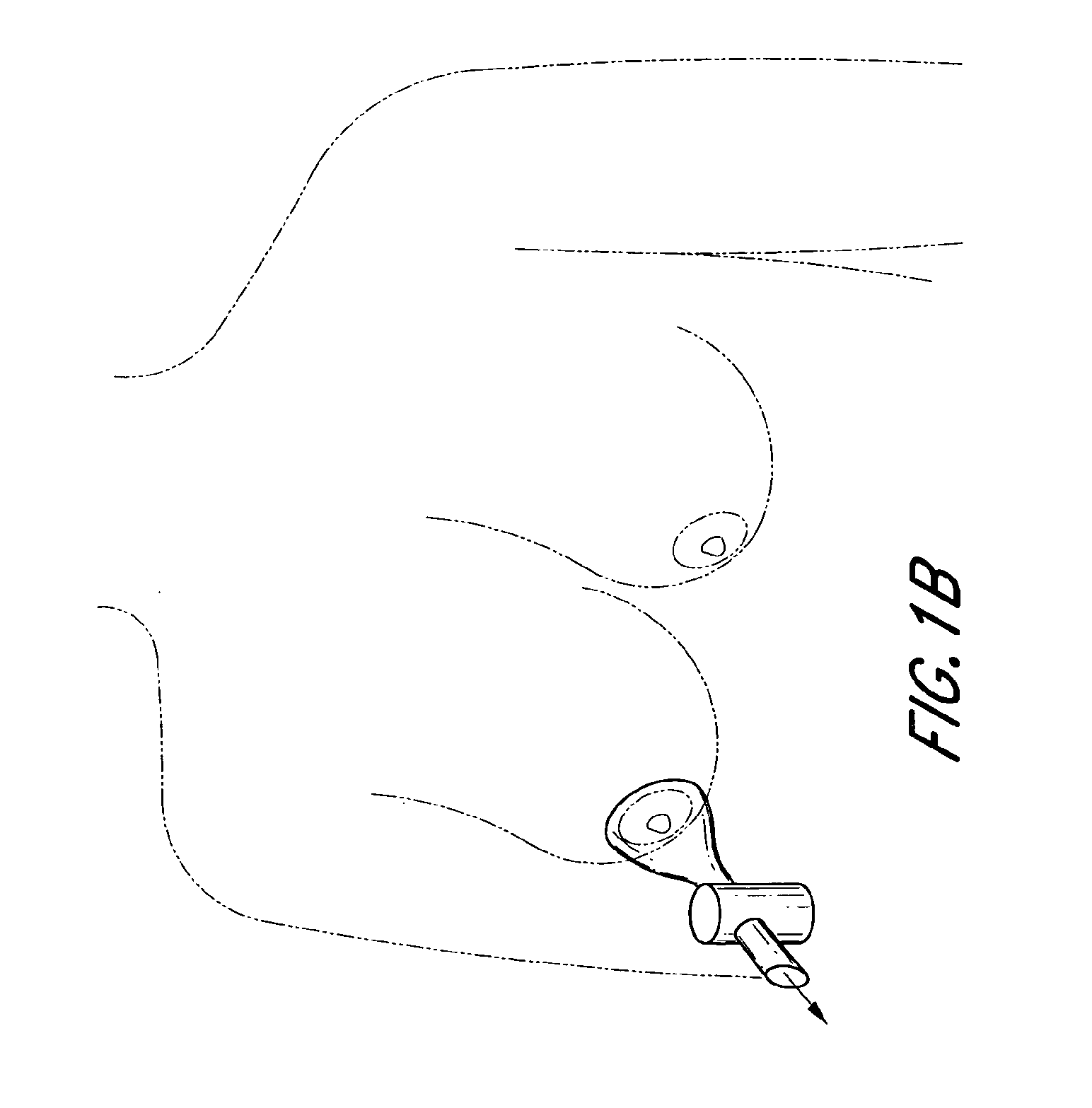 Device for determining risk of developing breast cancer and method thereof