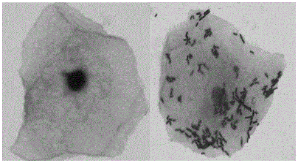 A strain of Lactobacillus jansnii and its application