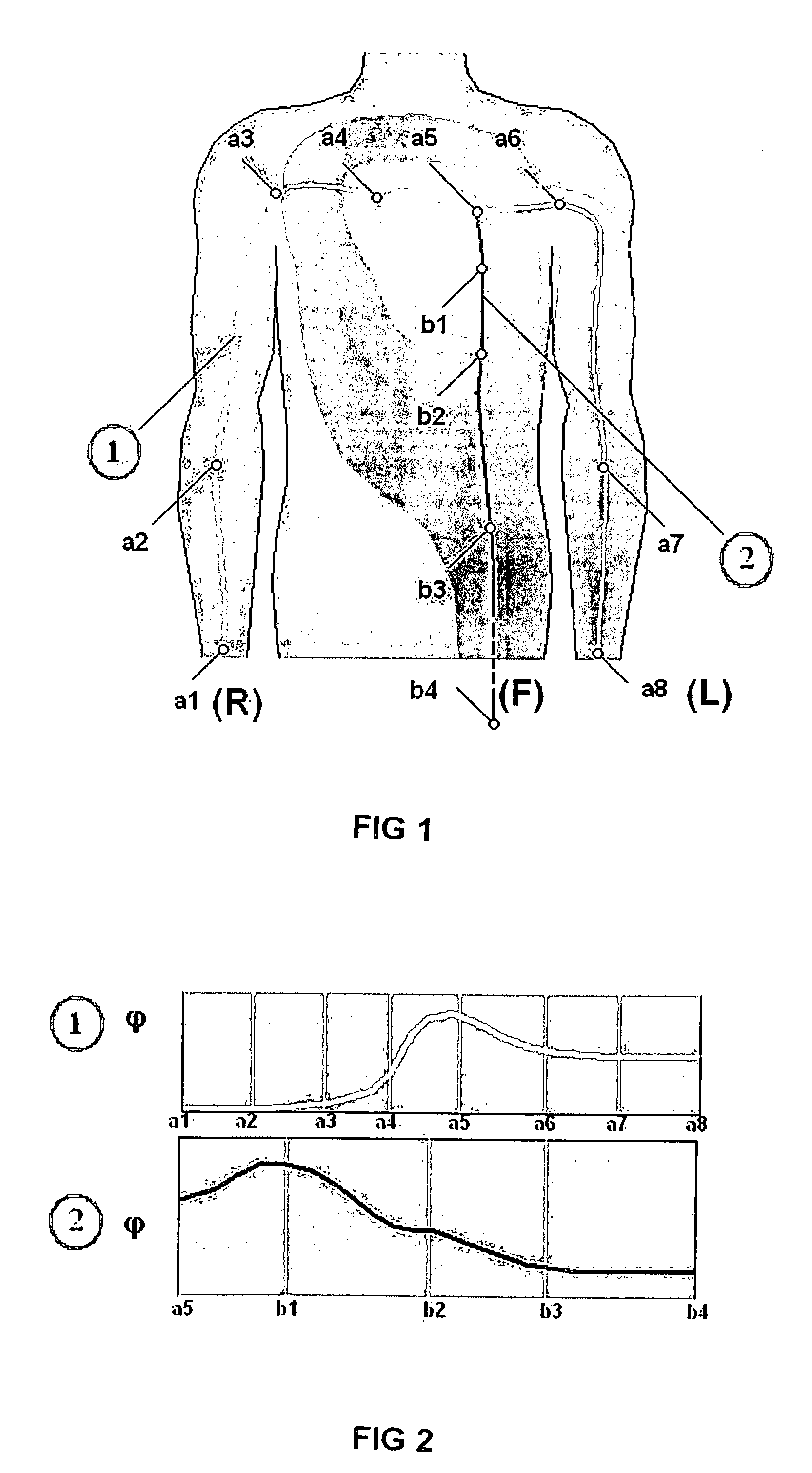 Diagnostic method utilizing standard lead ECG signals