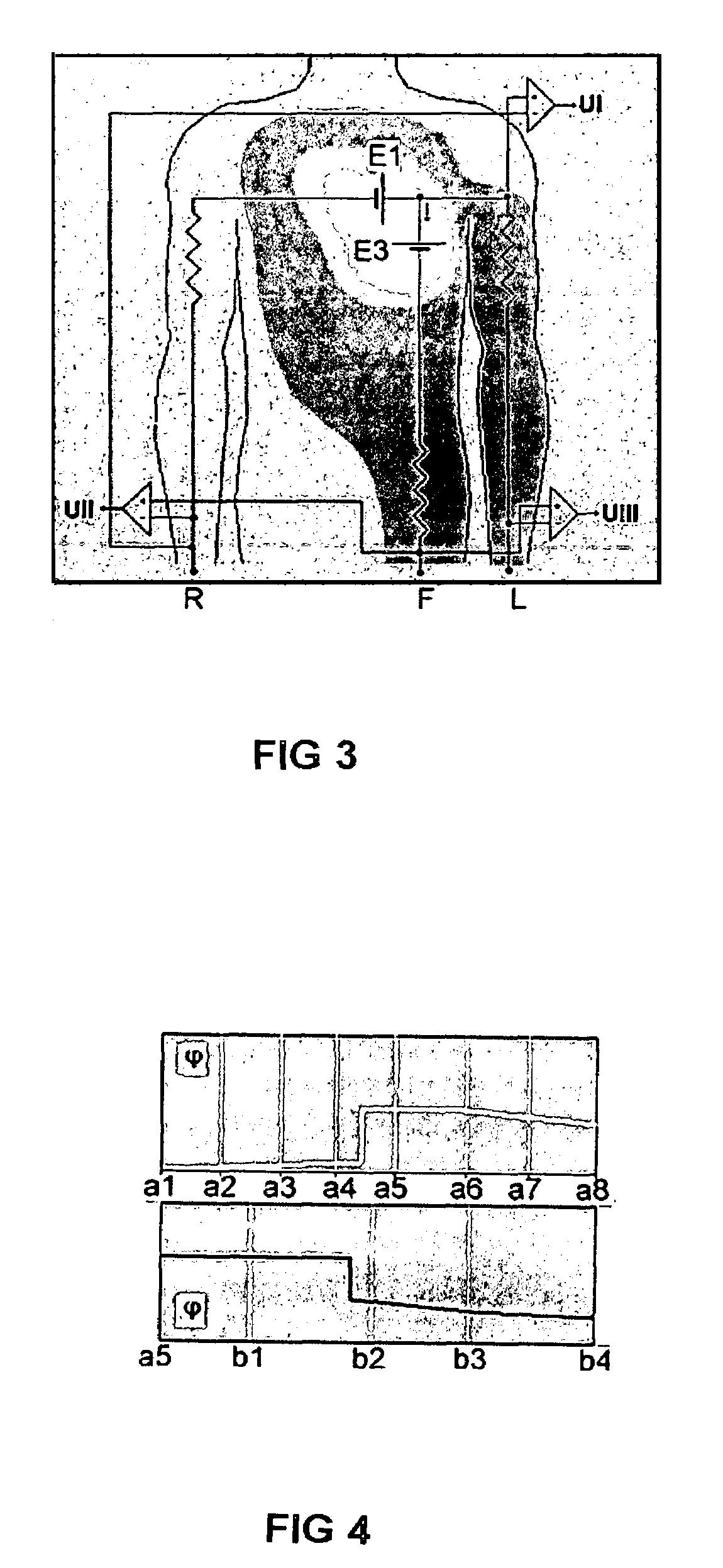 Diagnostic method utilizing standard lead ECG signals