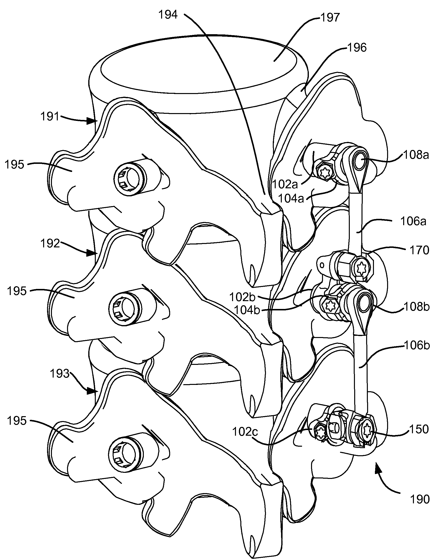 Load-sharing bone anchor having a deflectable post and method for stabilization of the spine