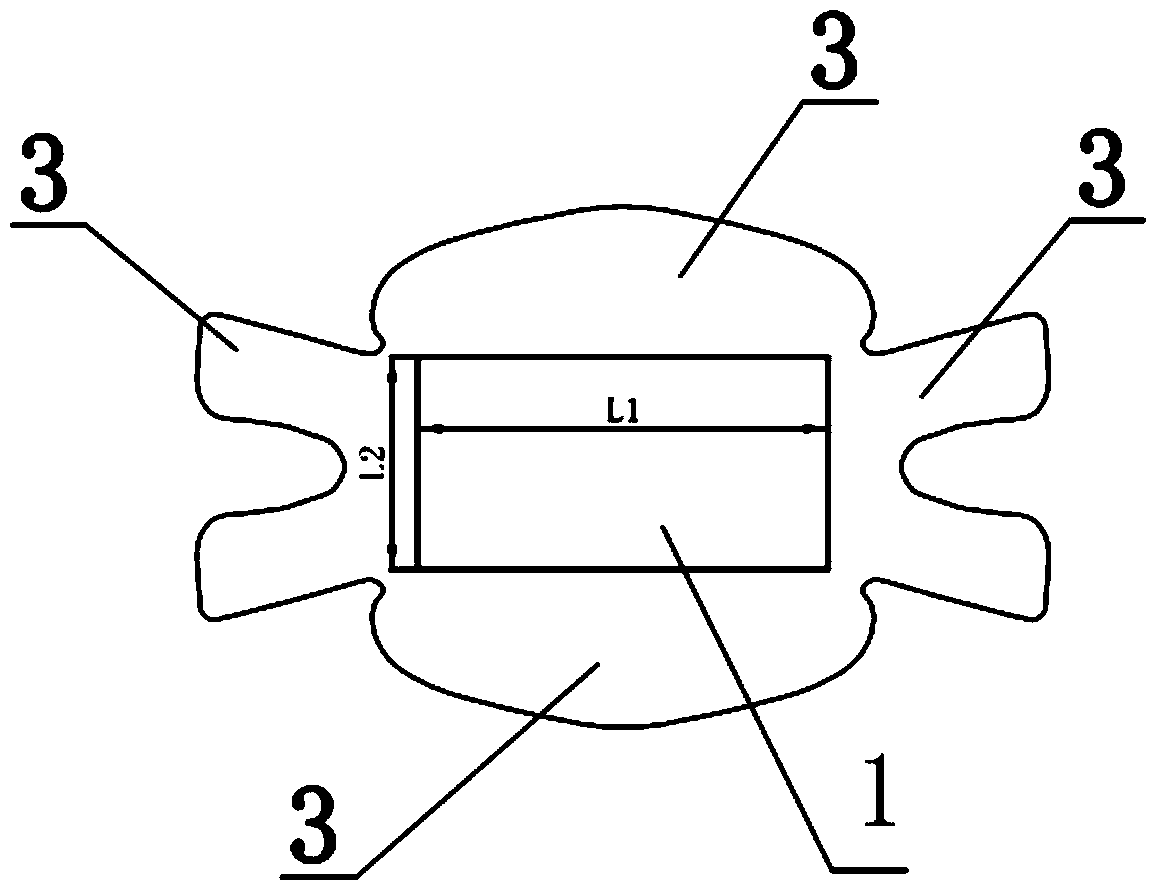 Special special-shaped plaster for anorectal and urinary operations