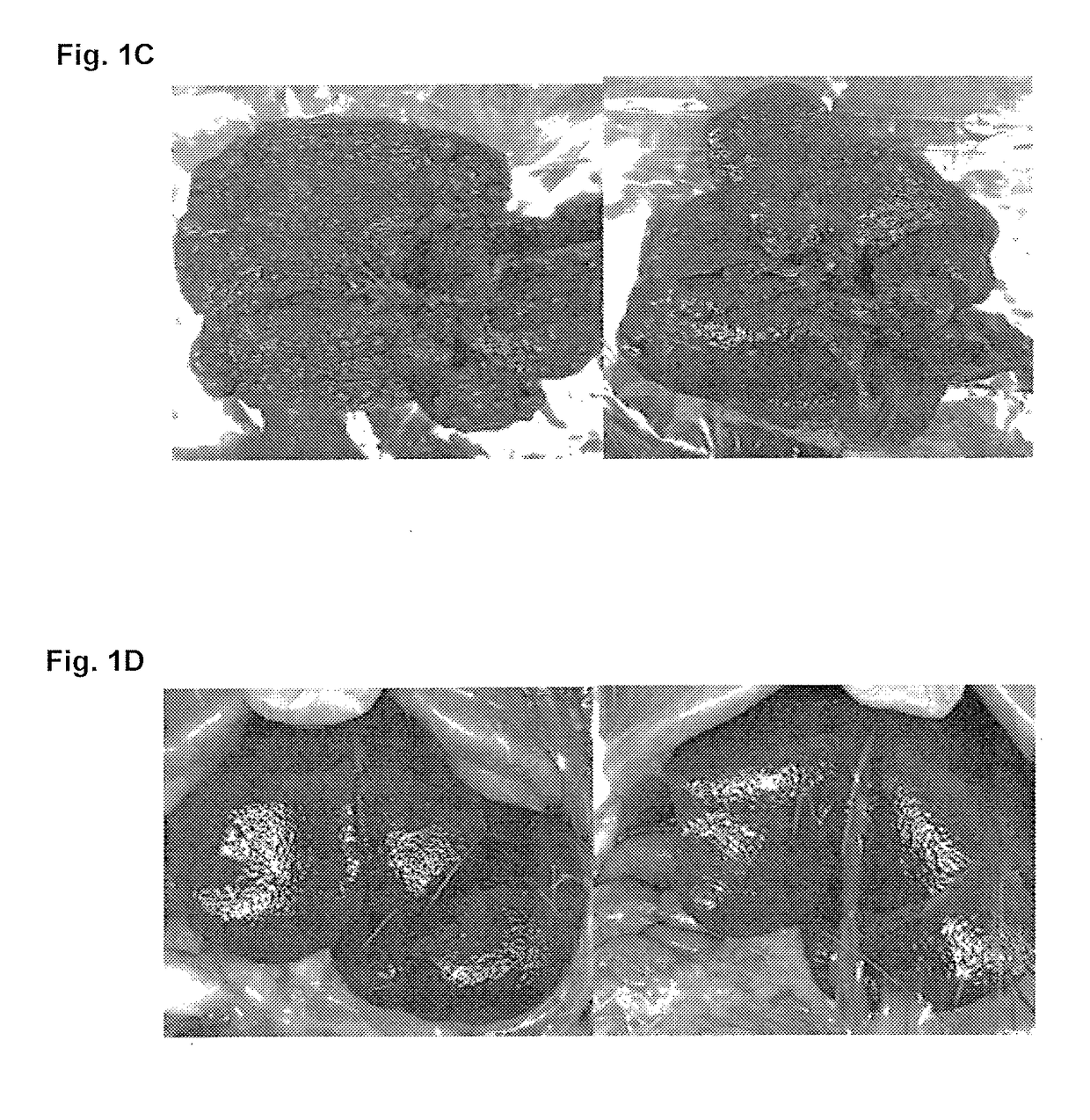 Treatment for hepatic fibrosis