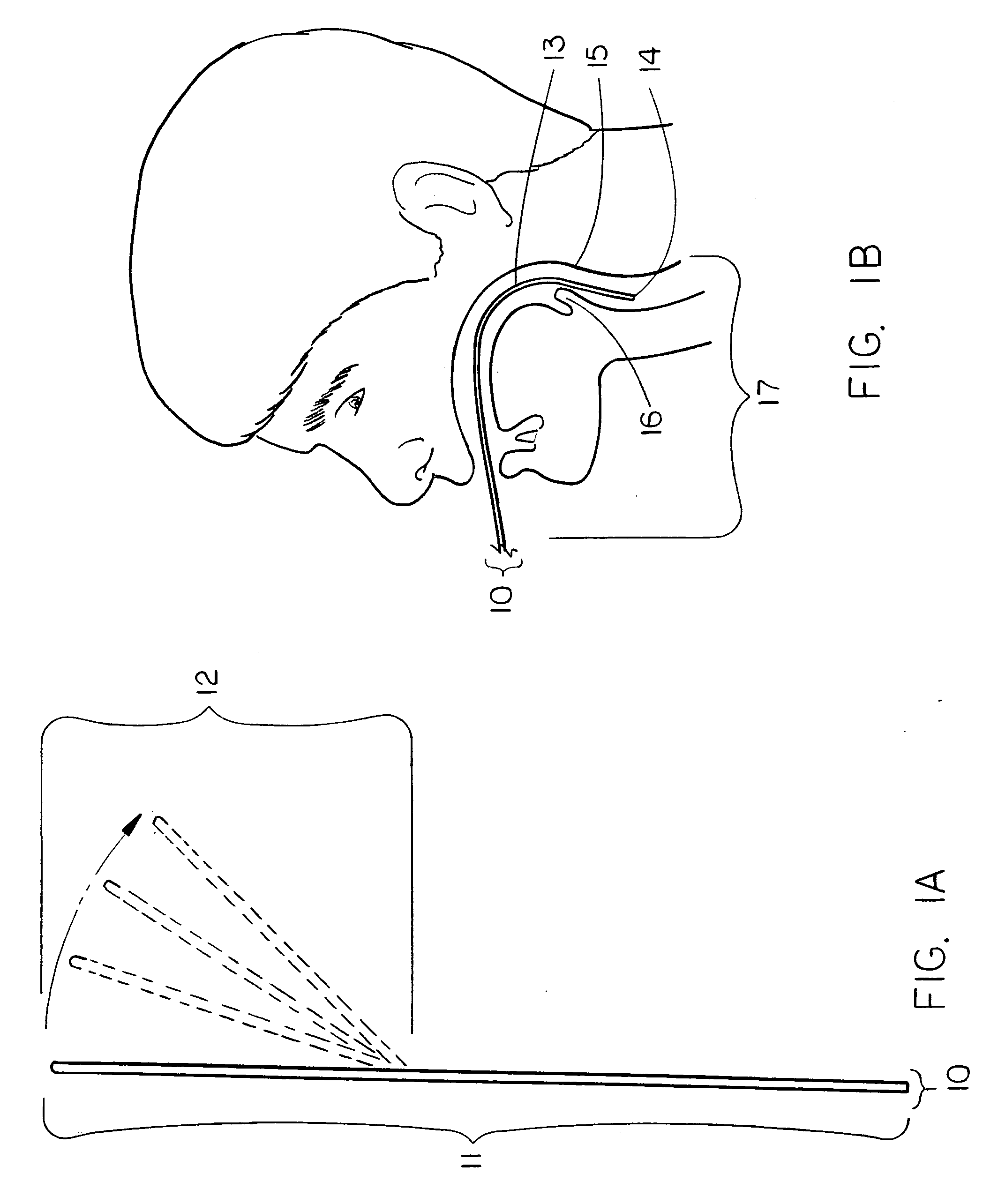 Intubation guide