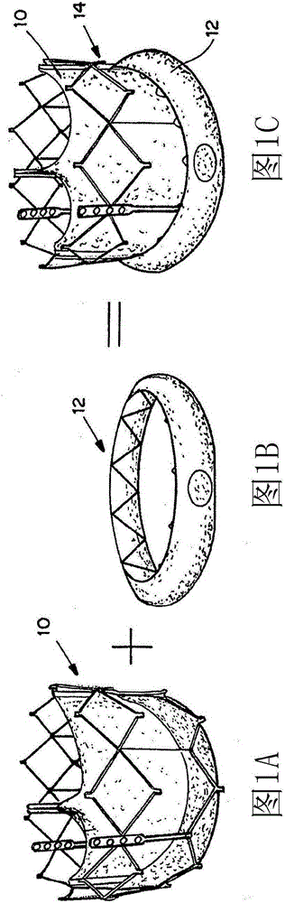 Means for controlled sealing of endovascular devices