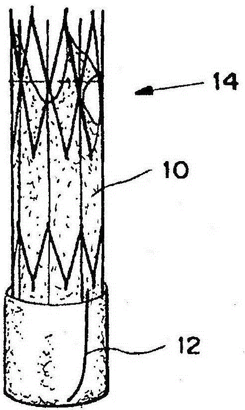 Means for controlled sealing of endovascular devices