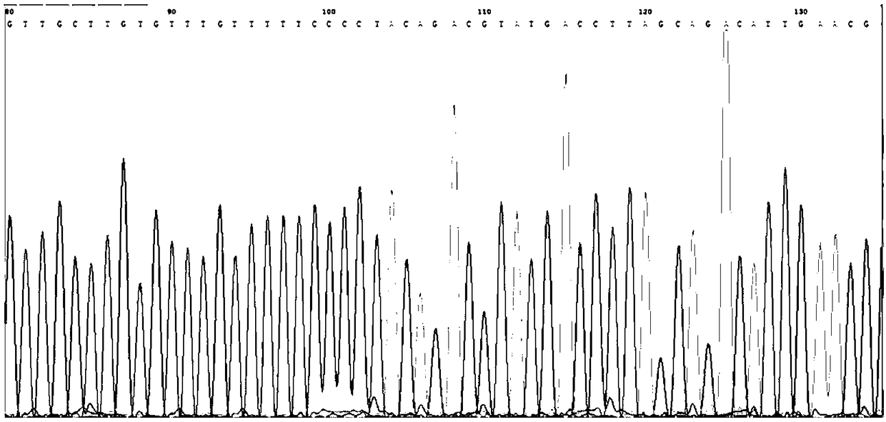 Citrin deficiency pathogenic gene detection primer and kit