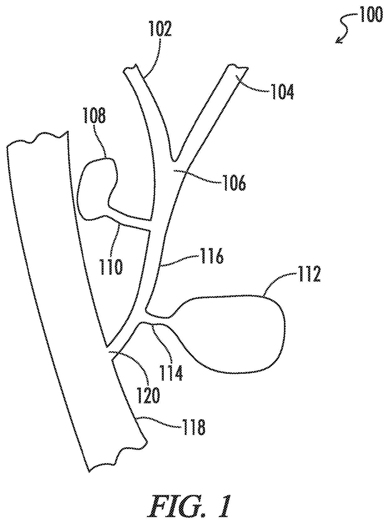 Biliary stent