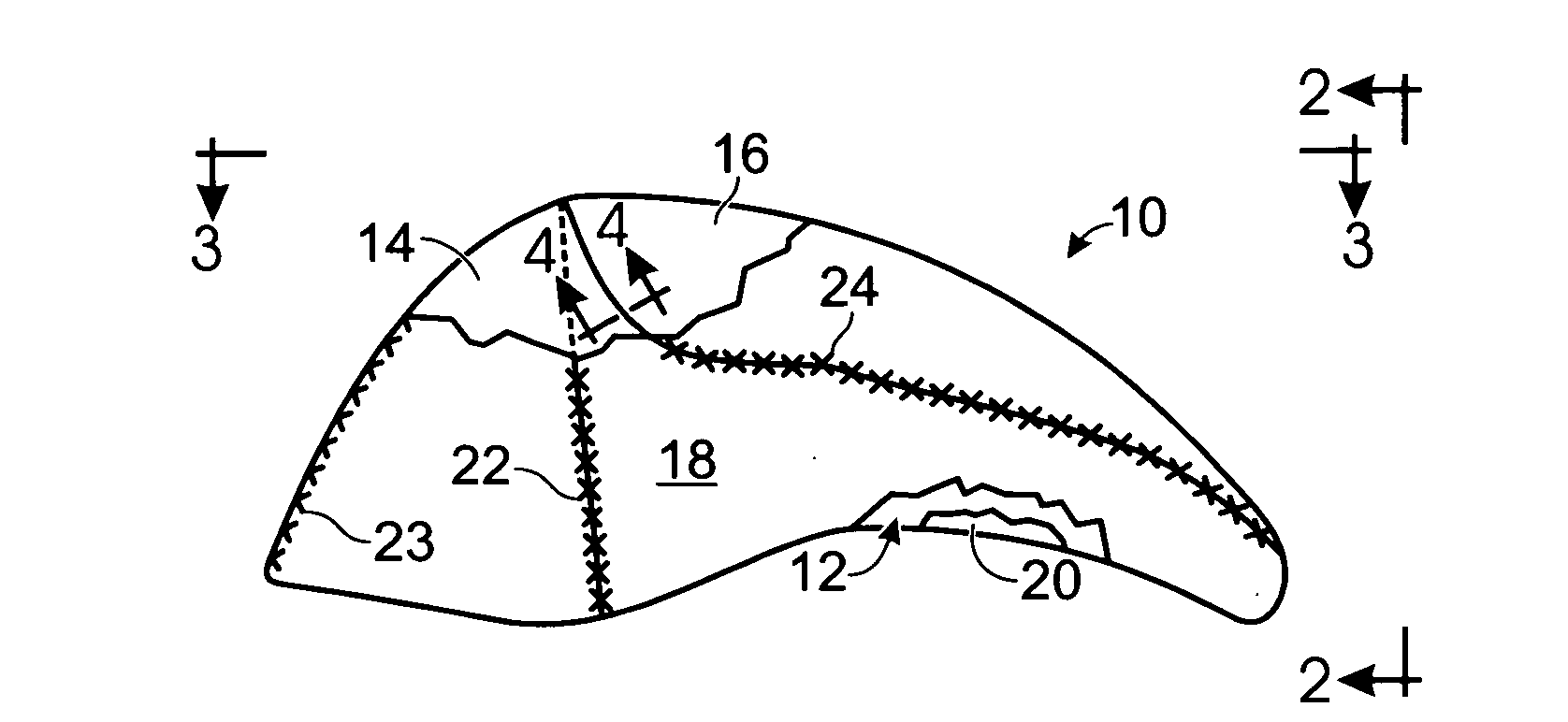 Helmet liner with improved, seam-position-enhanced, rear-sector load management