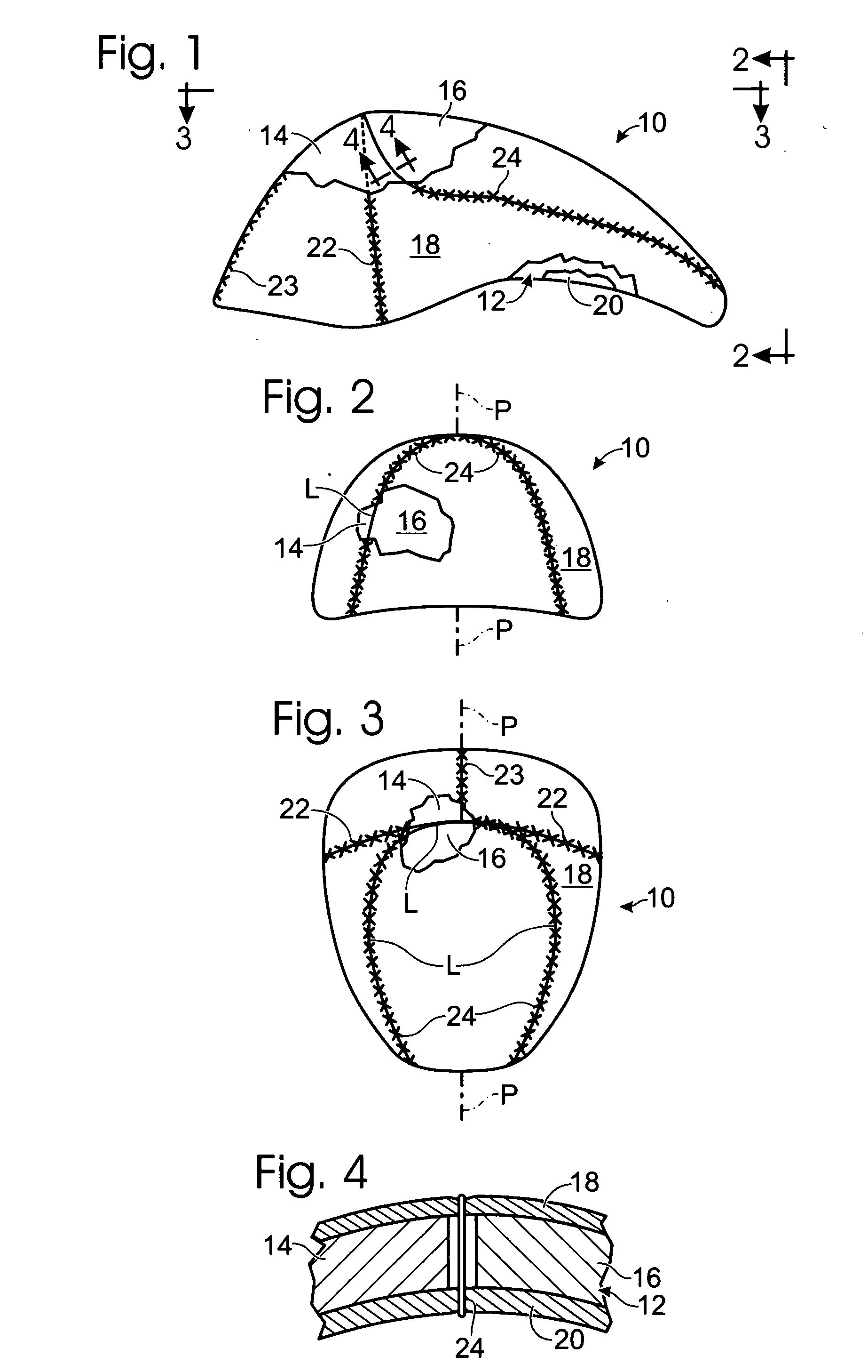 Helmet liner with improved, seam-position-enhanced, rear-sector load management