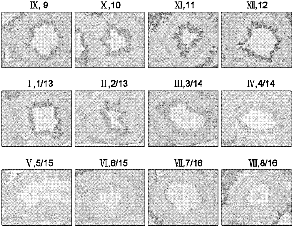 Animal model with male reproductive disorders, as well as preparation method and application thereof