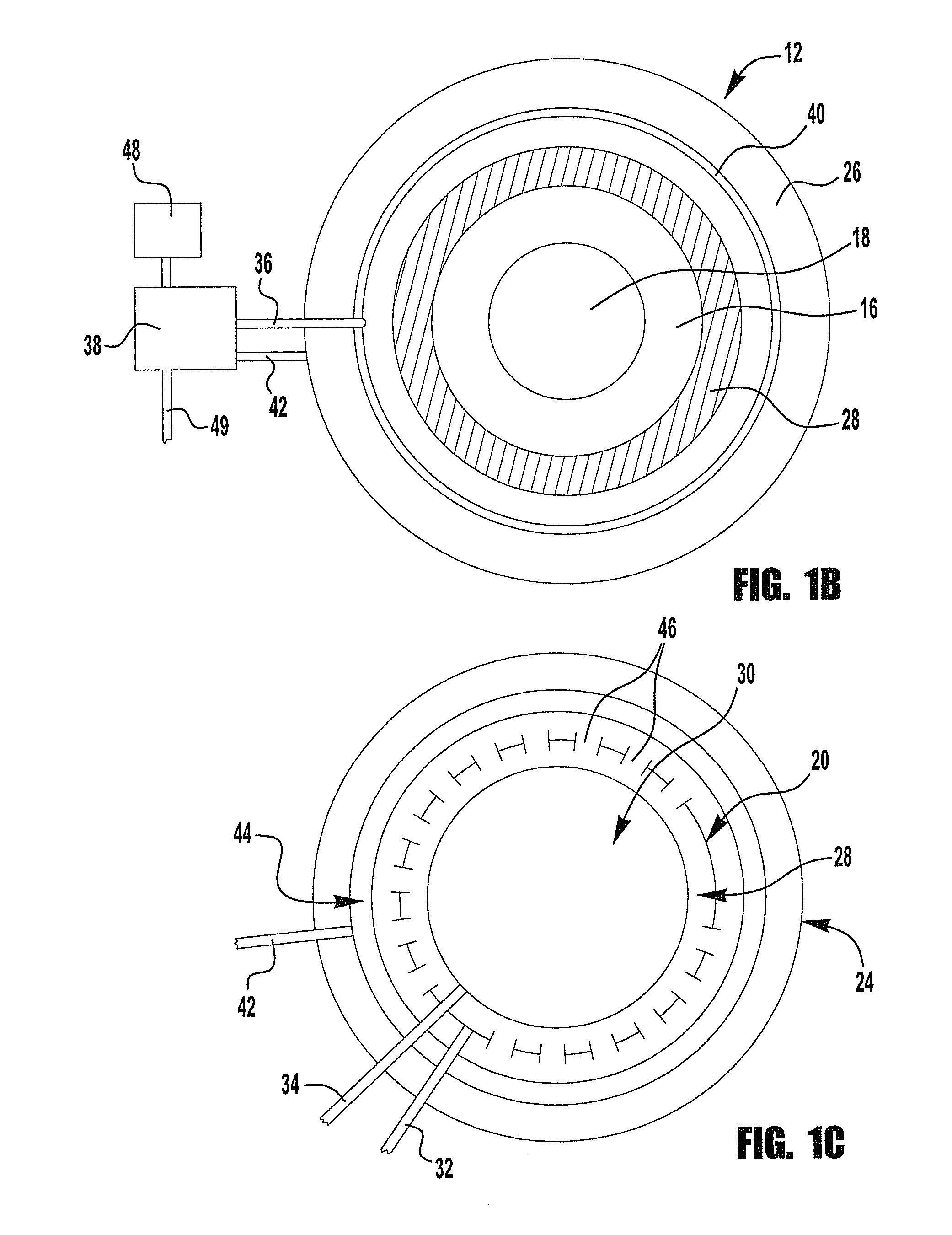 Carbon dioxide removal systems