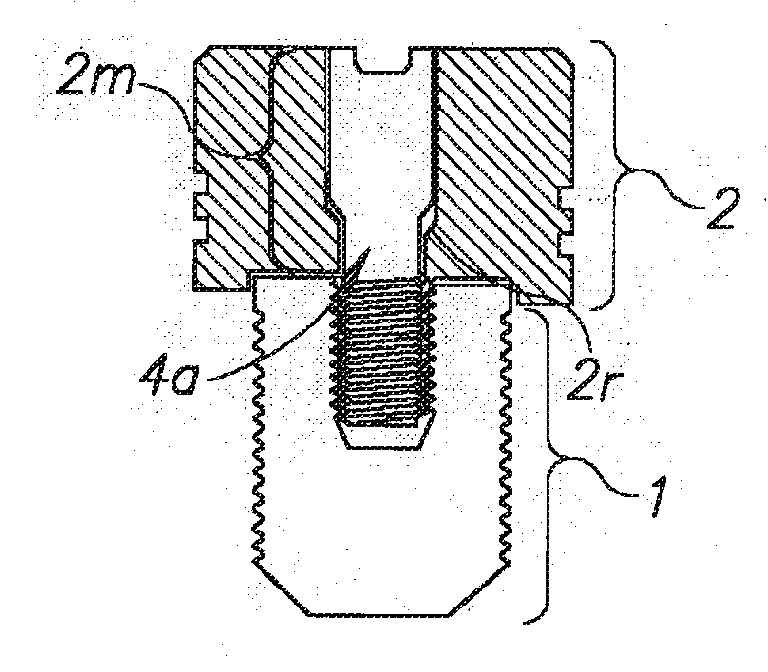 System, apparatus and method for implementing implants