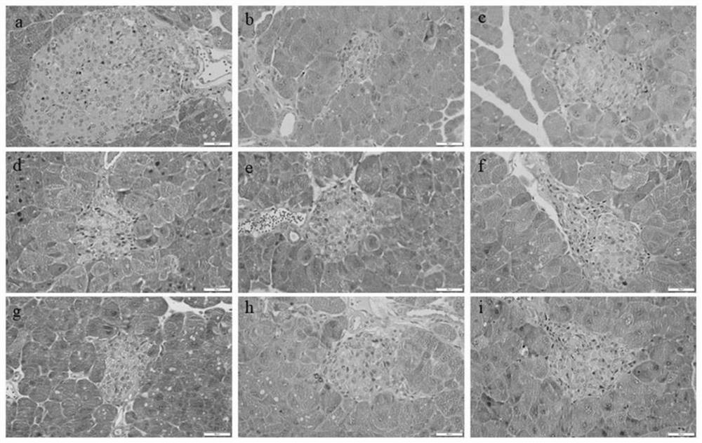 Application of GLP-1R micromolecule agonist in diabetes and related complications and medicine