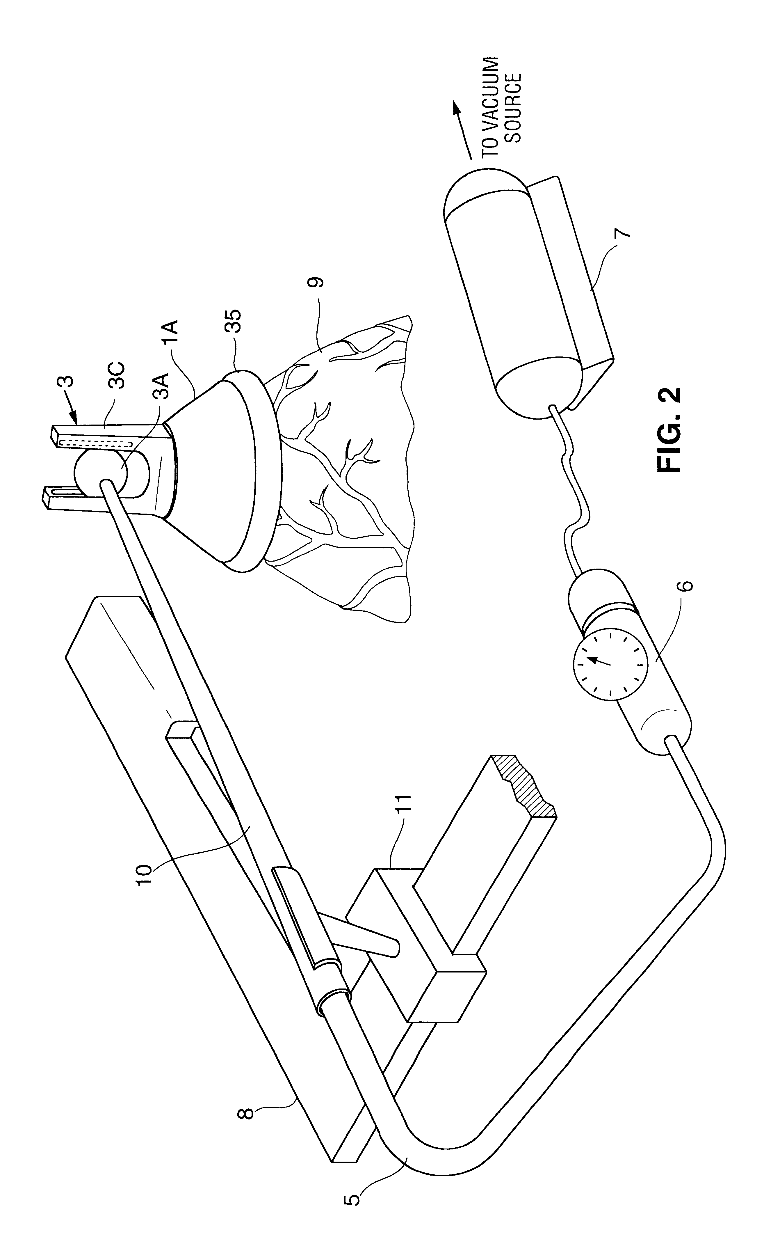 Organ manipulator having suction member supported with freedom to move relative to its support